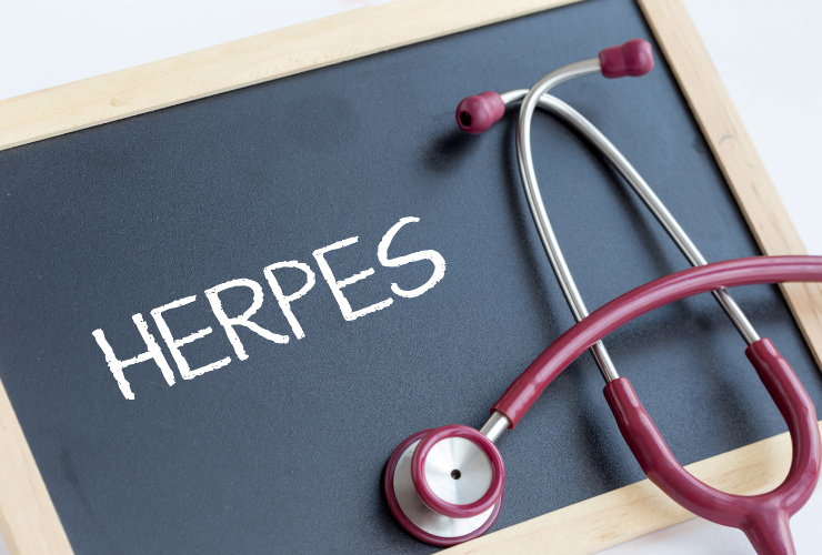 Čo pomáha na herpes a kedy je herpes infekčný? Pýtali sme sa MUDr.Gustáva Kalauza>