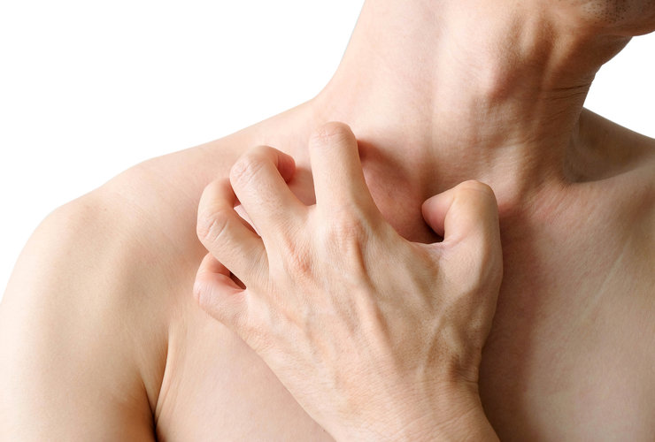 Prečo sladkosti zhoršujú svrbenie pokožky?